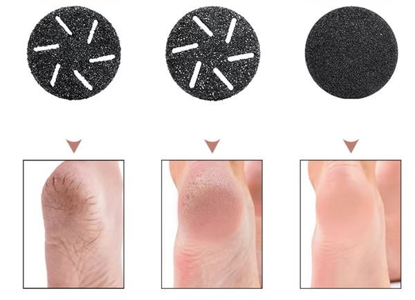 Rechargeable Callus Remover