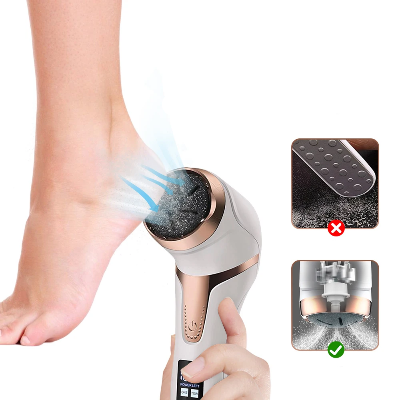 Rechargeable Callus Remover